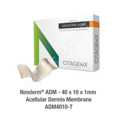 Neoderm ADM 40x10x1mm Acellular dermis membrane