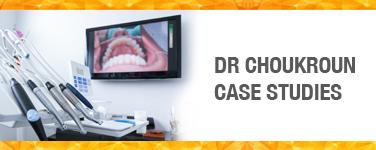 Dr Choukroun Case Studies